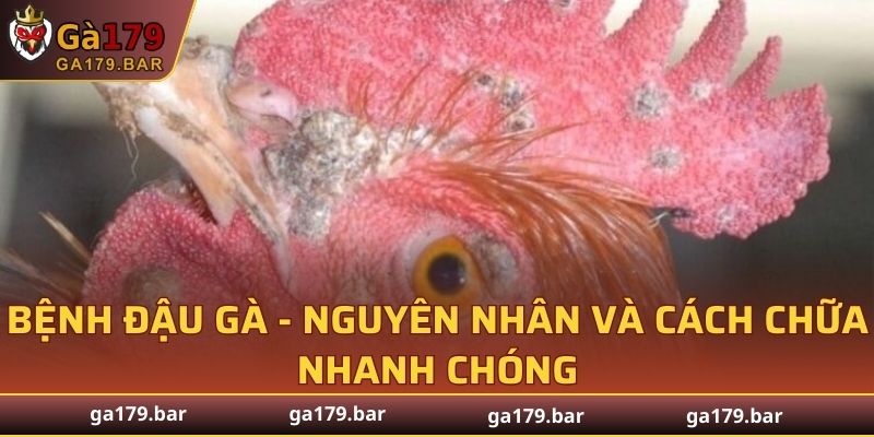 Bệnh Đậu Gà