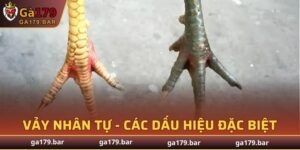 Vảy Nhân Tự